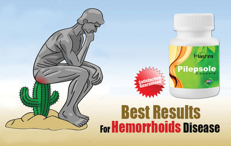 Ways to Treat Haemorrhoids